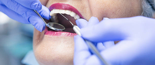 Best Emergency Dental Services for Seniors in Union, KY